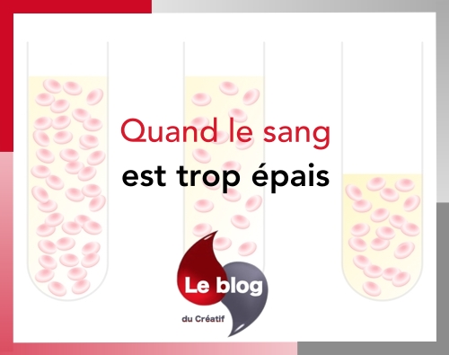 038 - sang trop epais